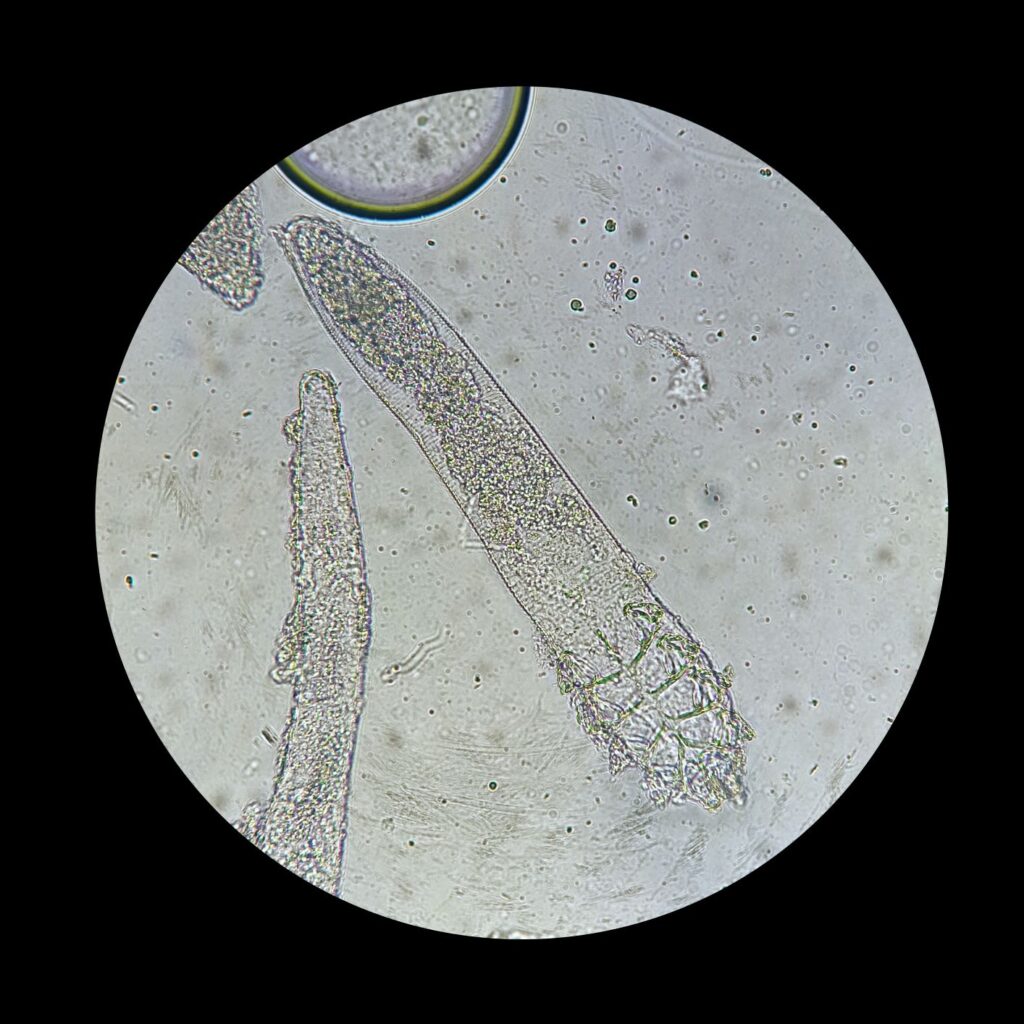 acariens de démodécie du chien au microscope