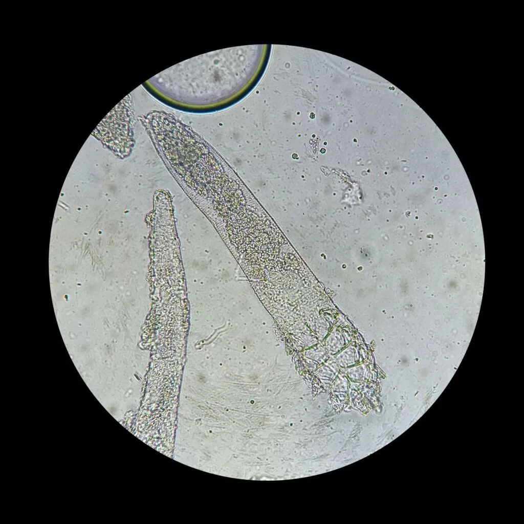 Acariens demodex canis qui provoquent la démodécie chez le chien